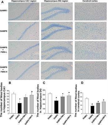 Transcriptome analysis of the aged SAMP8 mouse model of Alzheimer’s disease reveals novel molecular targets of formononetin protection